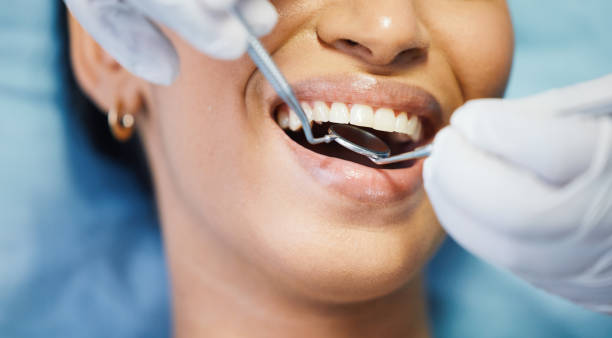 Best Emergency Dental Care for Abscessed Tooth in Saybrook Manor, CT